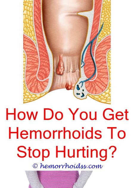 10 Hardy Clever Ideas: Will My Thrombosed Hemorrhoid Go Away On Its Own ...