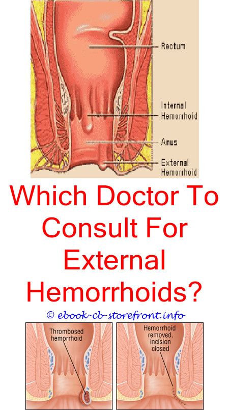 10+ Refined Hemorrhoid Young Living Ideas