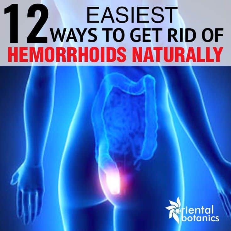 12 Easiest Ways to Get Rid of Hemorrhoids Naturally