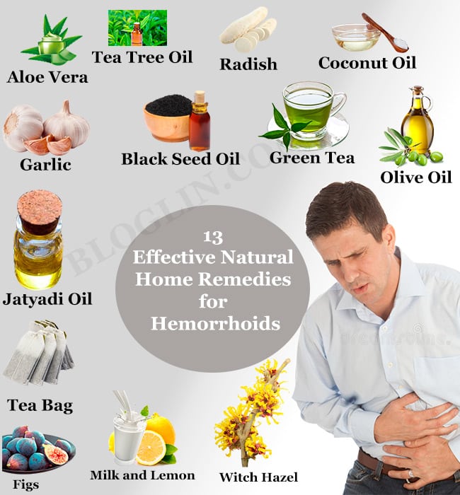 13 Top Natural Home Remedies for Piles or Hemorrhoids