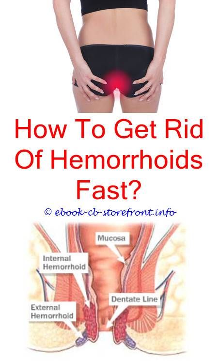 3 Marvelous Clever Tips: How To Stop Bleeding Internal Hemorrhoid where ...