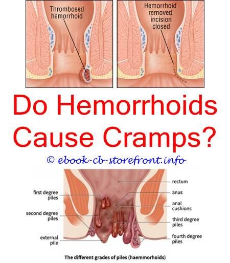 3 Relaxing Clever Ideas: Can Antibiotics Cause Hemorrhoids To Flare Up ...