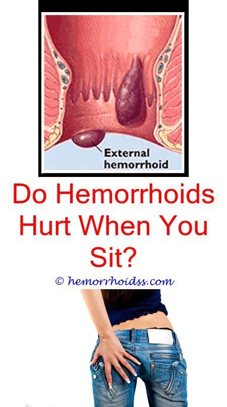 3 Sublime Tips: What Causes Hemorrhoids To Get Worse? how ...