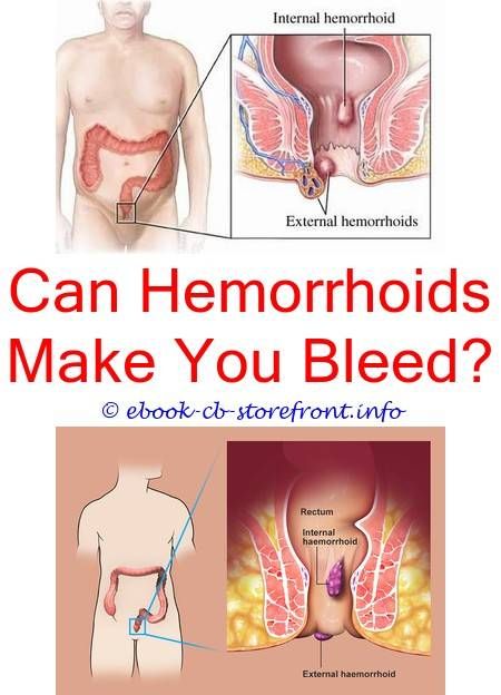 4 Refreshing ideas: What To Do About Dog Hemorrhoids are ...