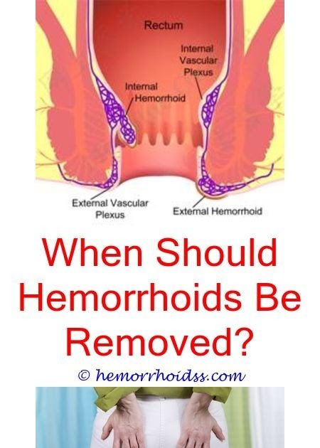 5 Stunning Tricks: Will Hemorrhoids Bleed? have a ...