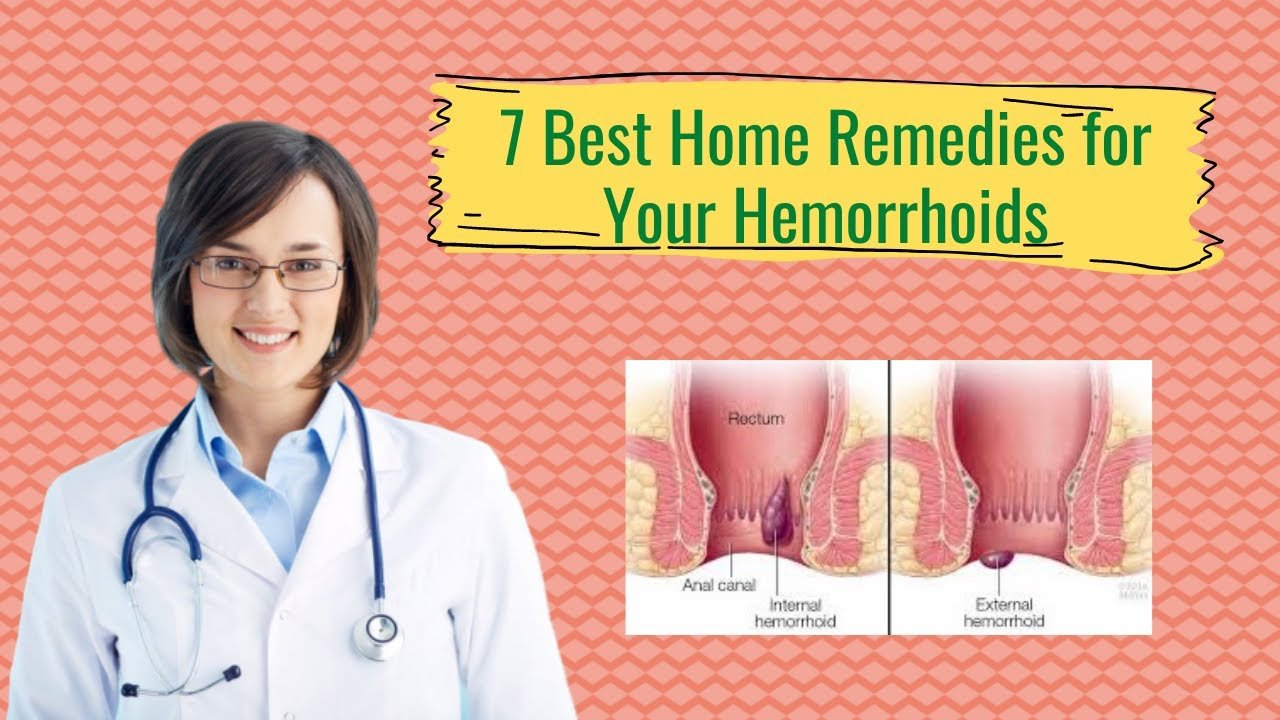 7 Best and Worst Home Remedies for Your Hemorrhoids