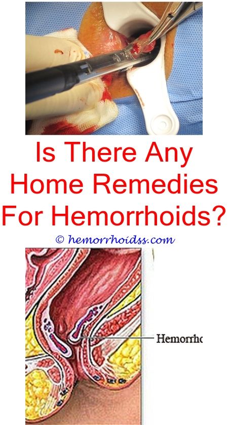 7 Startling Unique Ideas: Can Hemorrhoids Itch On The ...
