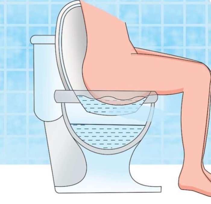 9 Home remedies for hemorrhoids that actually work