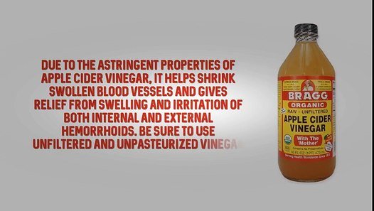 Apple cider vinegar for hemorrhoids naturally fast and ...