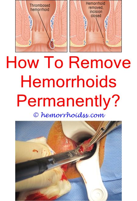 Are Bleeding Hemorrhoids Dangerous?