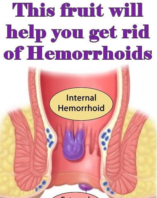 Best Diet For Hemorrhoids