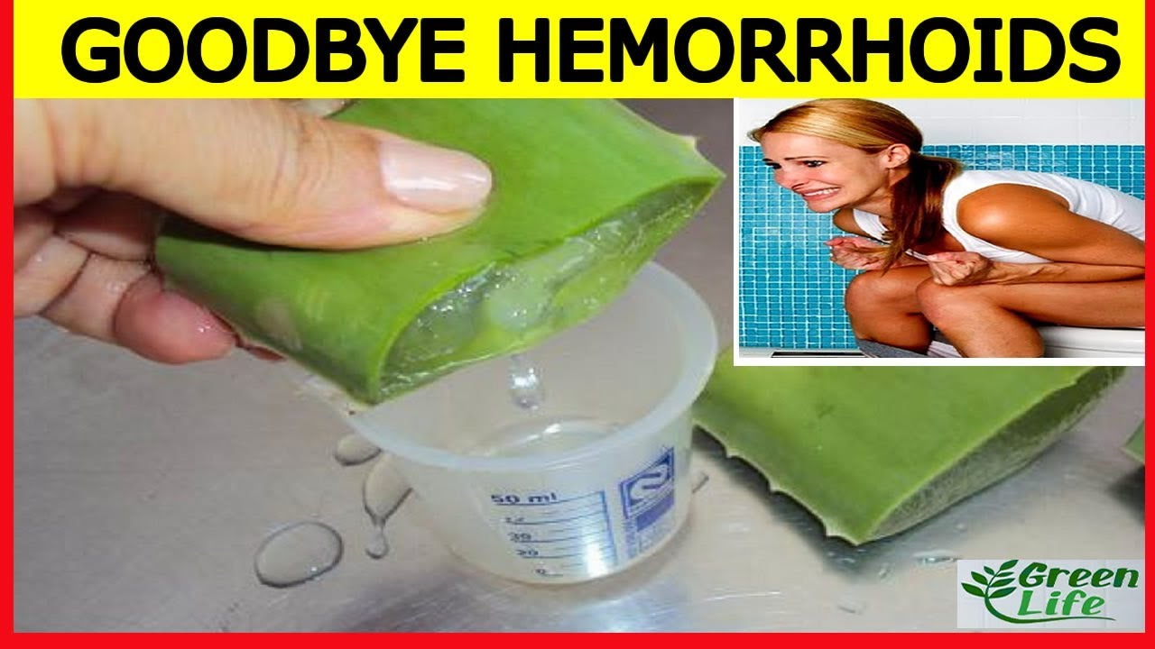 Best Hemorrhoids Treatment, How To Get Rid Of Hemorrhoids Fast ...