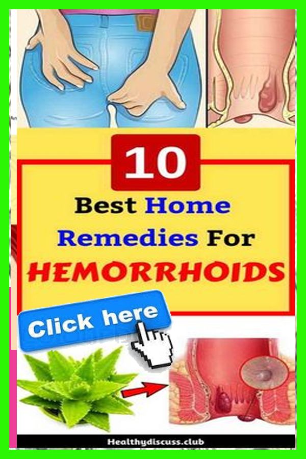 Best way to get rid of hemorrhoids fast