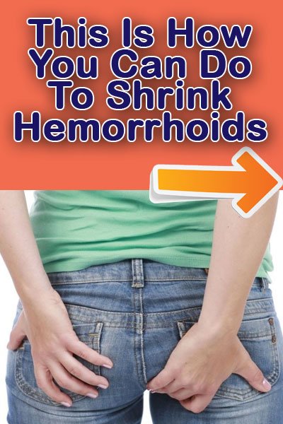 Best Way To Shrink Hemorrhoids Fast Effectively: Natural ...