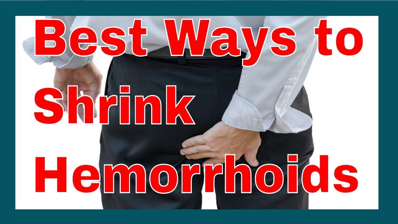 Best Ways to Shrink Hemorrhoids  The Natural Cure