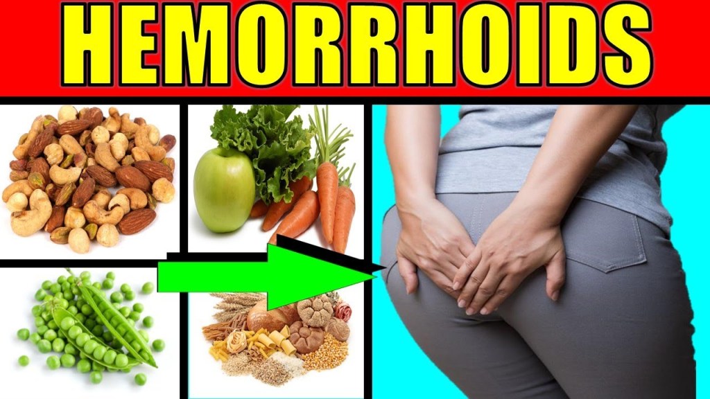 Best &  Worst Foods to Eat With Hemorrhoids/ How to Reduce Risk and ...