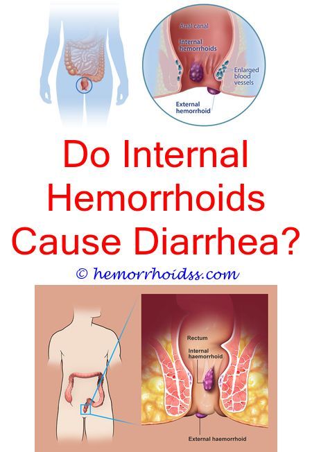 Can hemorrhoids also cause a rash?.How to prevent ...