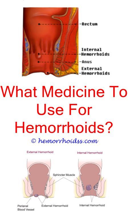Can Hemorrhoids Bleed After Diarrhea? what is a non ...