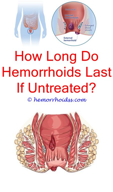 Can Hemorrhoids Make You Feel Constipated? how to get rid ...