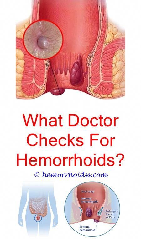 Can I Die From Hemorrhoids? how long bleeding hemorrhoids last?.What ...