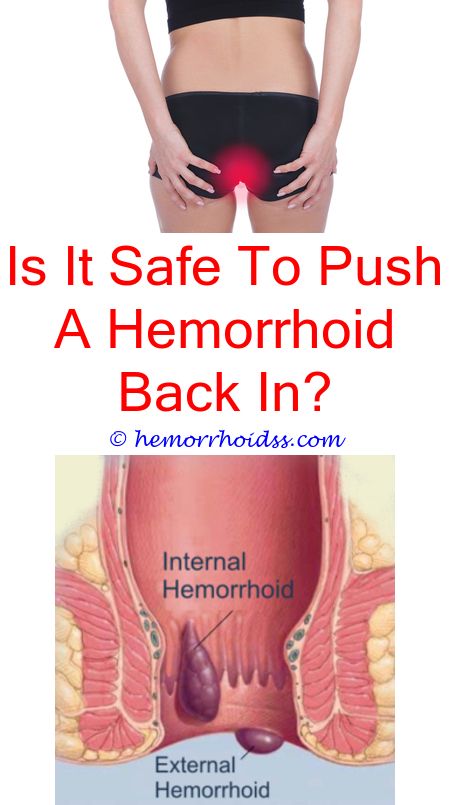Can You Get Hemorrhoids From Eating Spicy Foods? does ...
