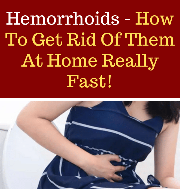 Can You Get Rid Of Hemorrhoids Permanently
