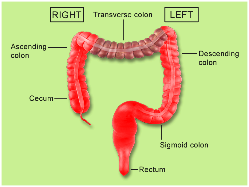 Cancer of the colon versus. rectal cancer: whatâs the difference ...