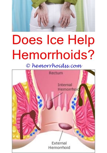 Do Hemorrhoids Go Away For Good? are internal hemorrhoids hereditary ...