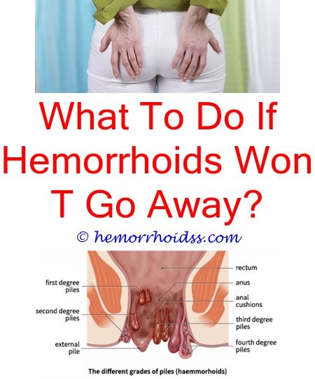 Do Hemorrhoids Go Away On Their Own?