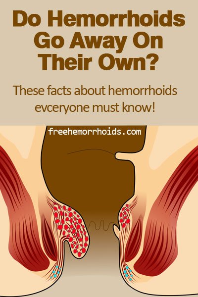 \ Do Hemorrhoids Go Away on Their Own? Important Facts You ...