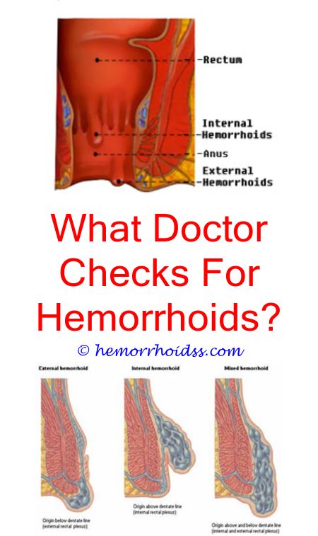 Do Hemorrhoids?