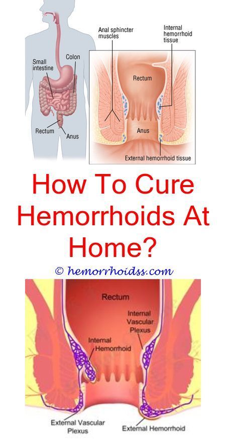 Do Hemorrhoids Make You Feel Like You Have To Pee? does hemorrhoid ...
