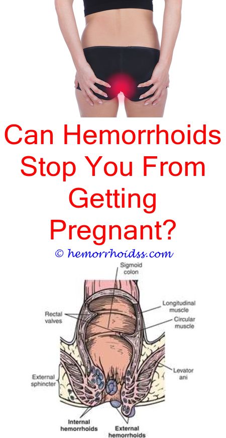 Do Hemorrhoids Need Medical Attention?