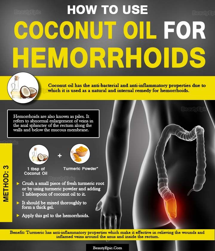 Does Coconut Oil Work for Hemorrhoids?