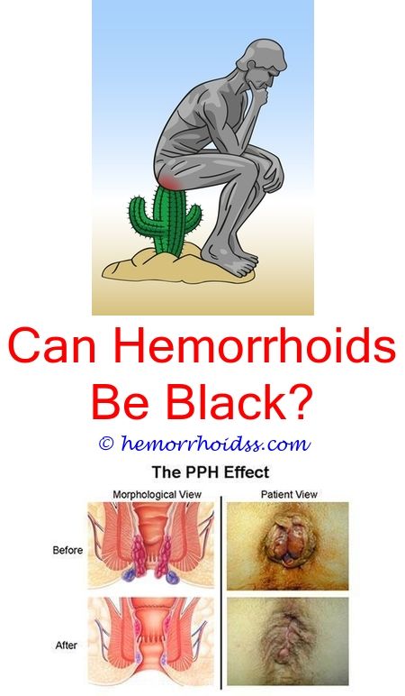 Does Hemorrhoid Cream Shrink Bags Under Eyes?