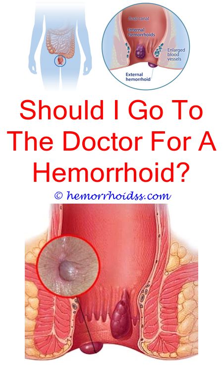 Does Hemorrhoid Cream Work To Tighten Skin? how to remove a hemorrhoid ...