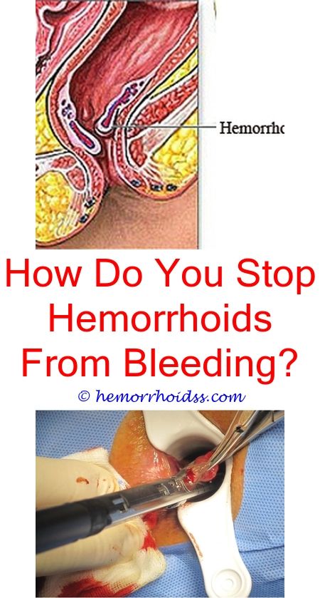 Does Ice Help Hemorrhoids?