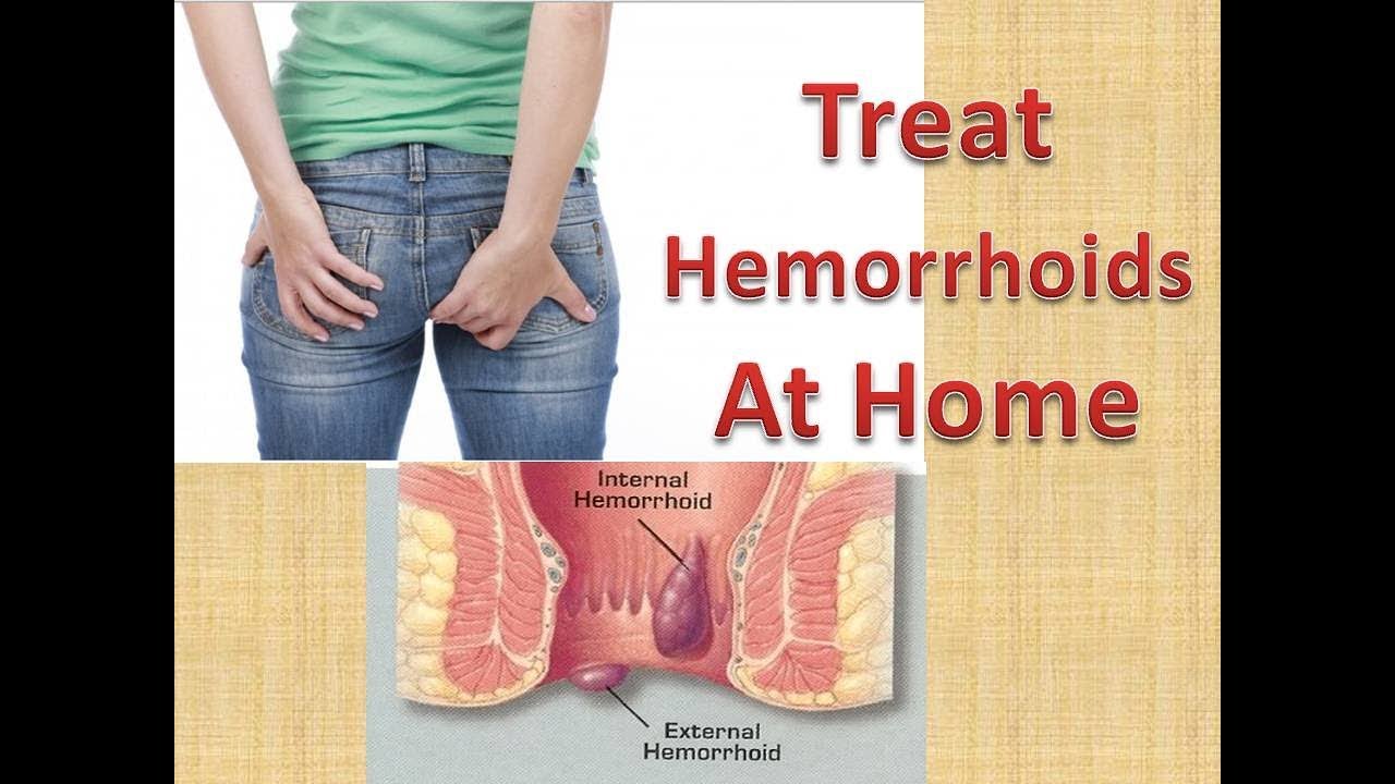 Does preparation h get rid of hemorrhoids: Help for ...