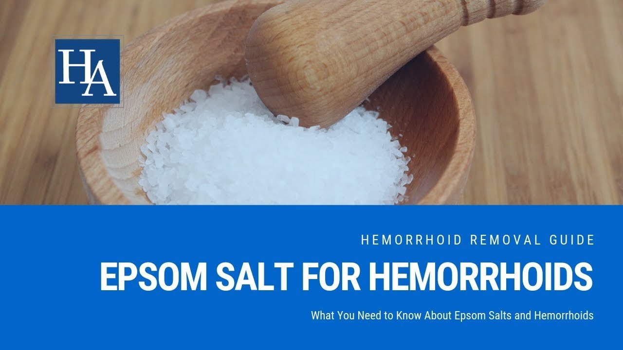 Epsom Salt for Hemorrhoids Relief: What You Need to Know ...