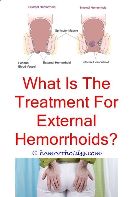Heal Hemorrhoids, nutrition specialist, Chronic ...