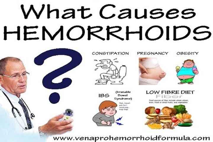 Heard About Hemorrhoids But Have No Clue About It? Here Is ...