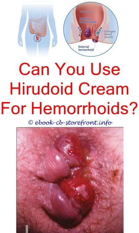 Hemorrhoid After Birth