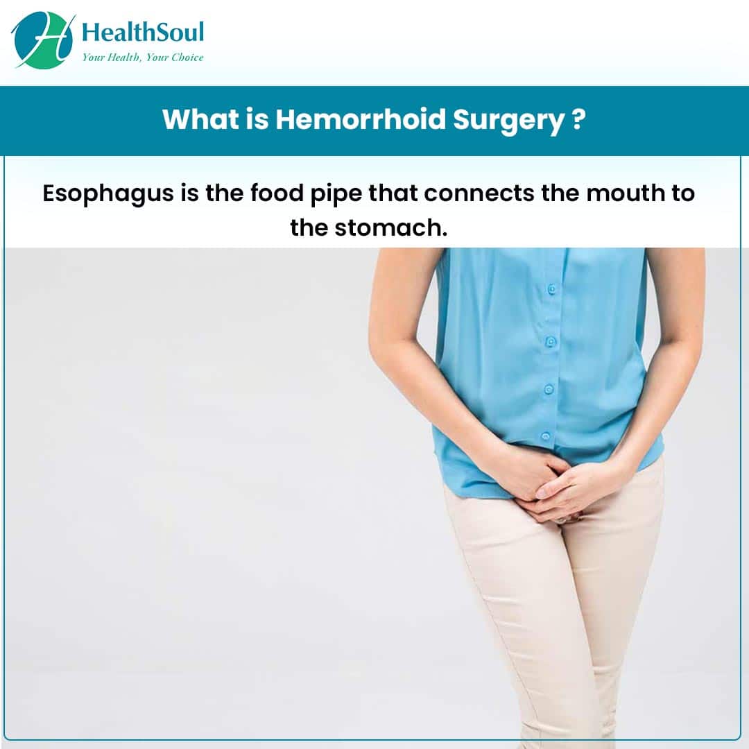 Hemorrhoid Surgery: Indications and Risks â Healthsoul