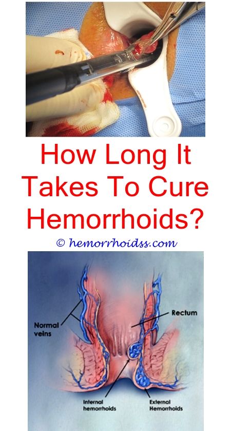 Hemorrhoids After Pregnancy C Section
