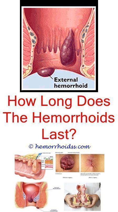 Hemorrhoids are an usual issue, specifically while ...