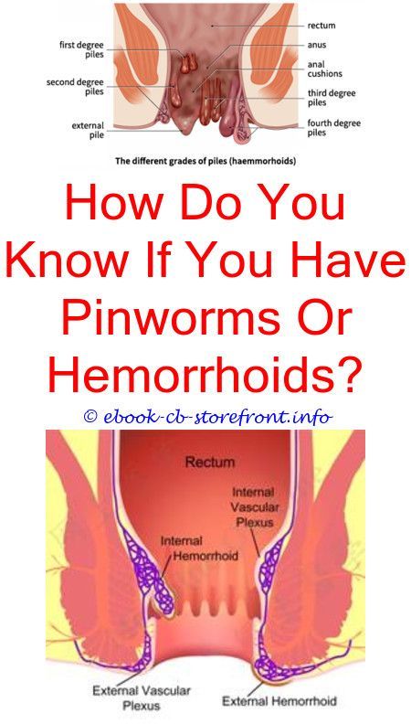 Hemorrhoids are normally extremely uncomfortable, however ...