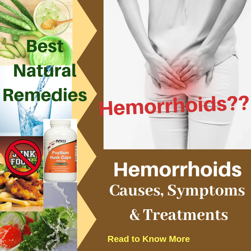 Hemorrhoids : Causes, Picture, Symptoms and Treatments