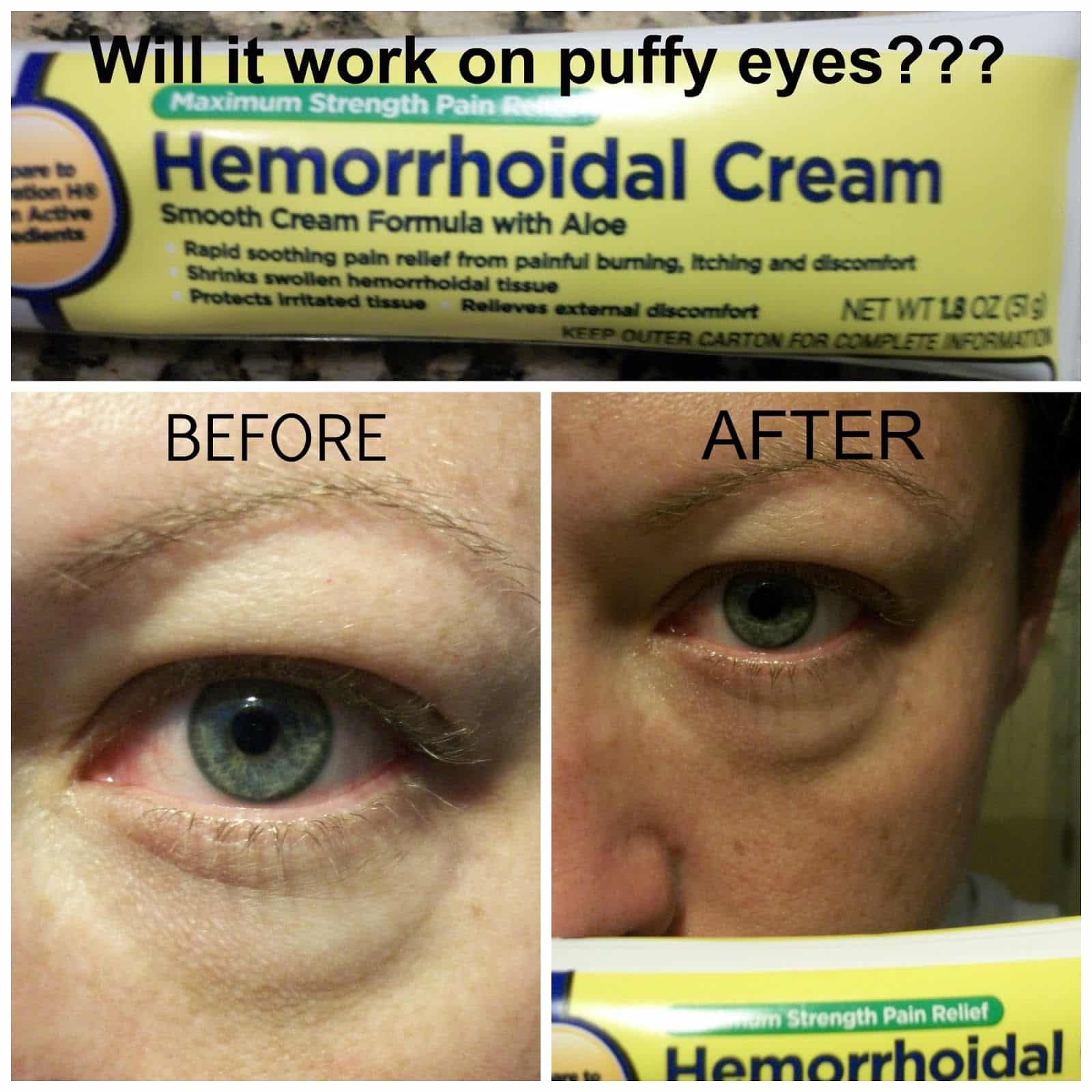 Hemorrhoids Cream For Eye Bags