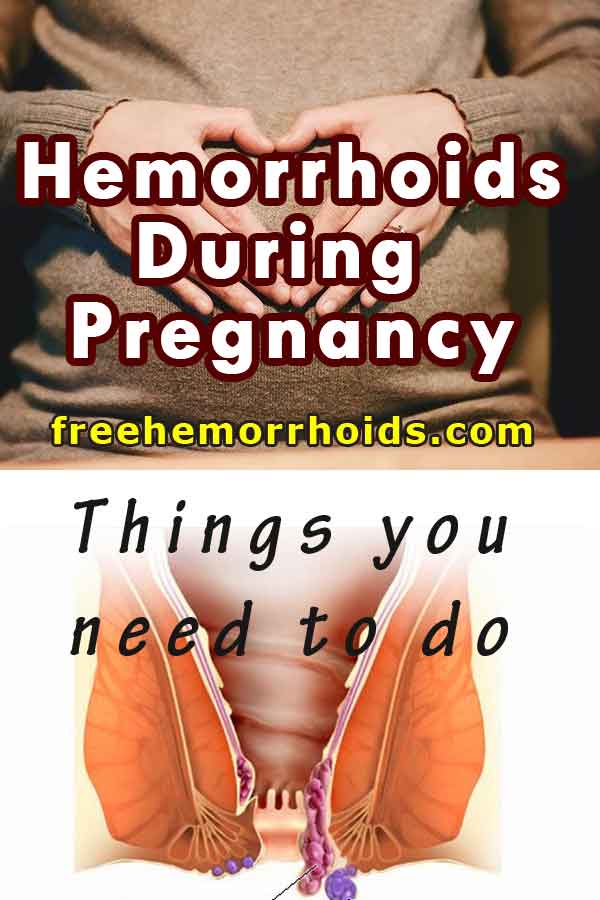 Hemorrhoids During Pregnancy: Things You Should Do To Deal With It ...