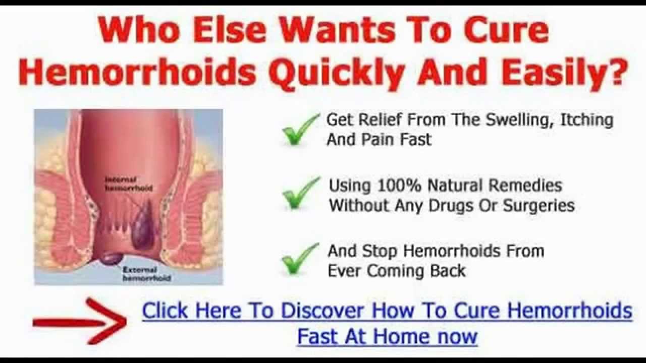 Hemorrhoids Home Treatment